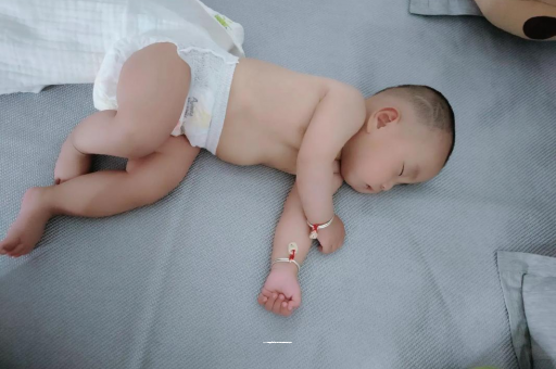 云浮宝宝头上长痱子